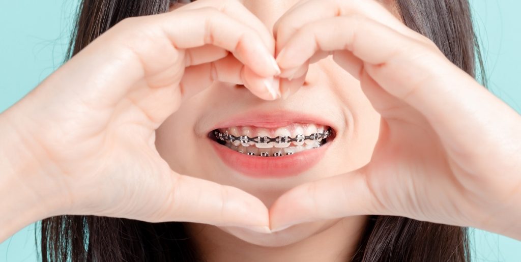 Orthodontist-in-Mission-Viejo-describes-what-foods-can-damage-your-braces