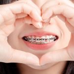 Orthodontist-in-Mission-Viejo-describes-what-foods-can-damage-your-braces