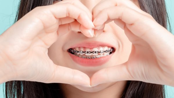 Orthodontist-in-Mission-Viejo-describes-what-foods-can-damage-your-braces