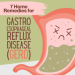 GERD is easily managed with home remedies.